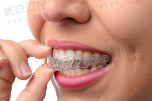 补假牙或者种牙什么区别,补牙贵还是镶牙贵(图1)